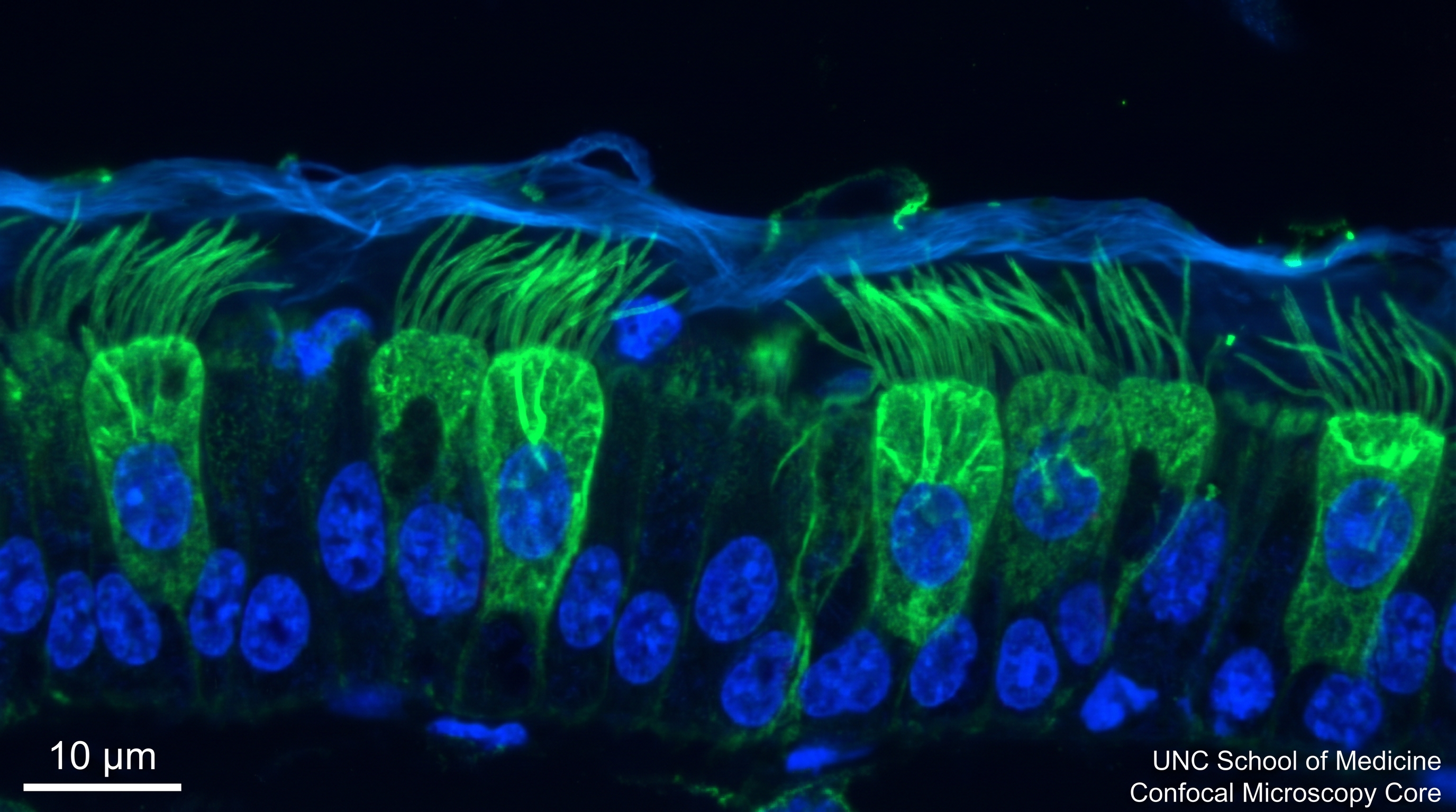 Airway epithelium microscopy